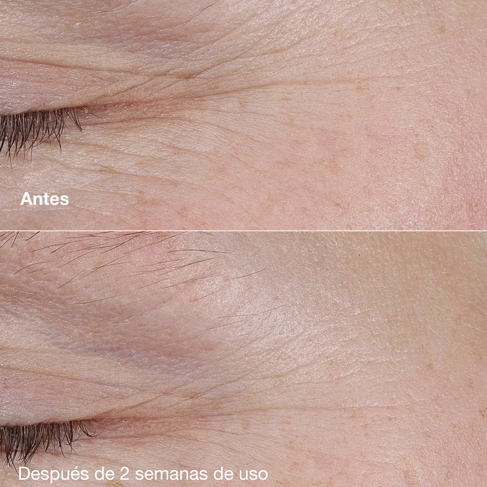 CLINIQUE SMART CLINICAL REPAIR™ AM/PM RETINOID BALM (TRATAMIENTO PARA CUIDADO DE LA PIEL)